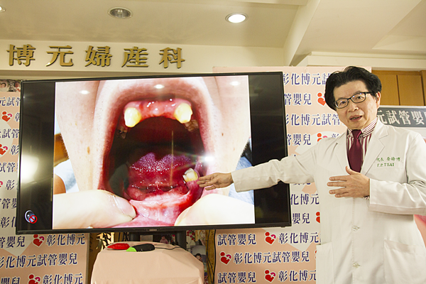 罕病者欲求健康子 盼政府專案補助胚胎快篩試管嬰兒1.png 罕病者欲求健康子 盼政府專案補助胚胎快篩試管嬰兒1.png