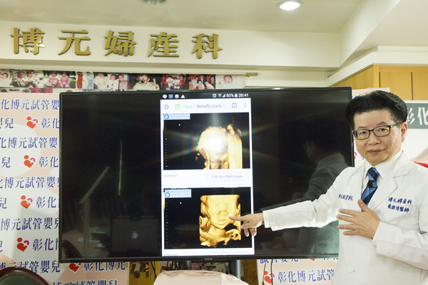 喜懷雙胞胎?恐憂同卵雙胞胎輸血症候群危機2.png 喜懷雙胞胎?恐憂同卵雙胞胎輸血症候群危機2.png