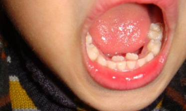 牙齒.png 牙齒.png