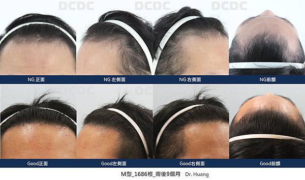 JJS-1050610_9M_黃(無露眉)-01.jpg JJS-1050610_9M_黃(無露眉)-01.jpg