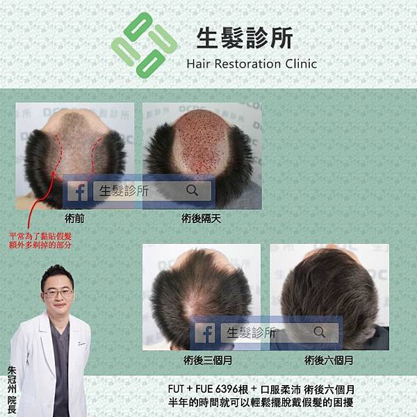 Y6m(2)_结果.jpg Y6m(2)_结果.jpg