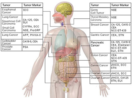 tumor_markers-rew.jpg