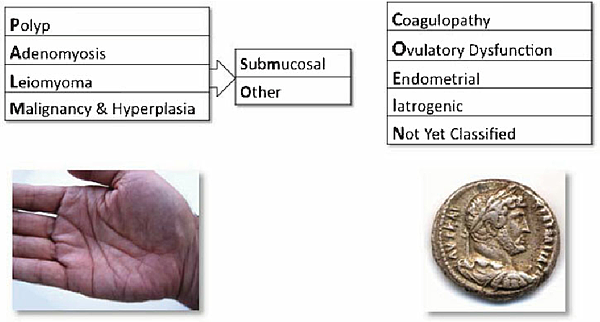 Figure-1-Basic-classification-system-The-basic-system-comprises-four-categories-that-are.png Figure-1-Basic-classification-system-The-basic-system-comprises-four-categories-that-are.png