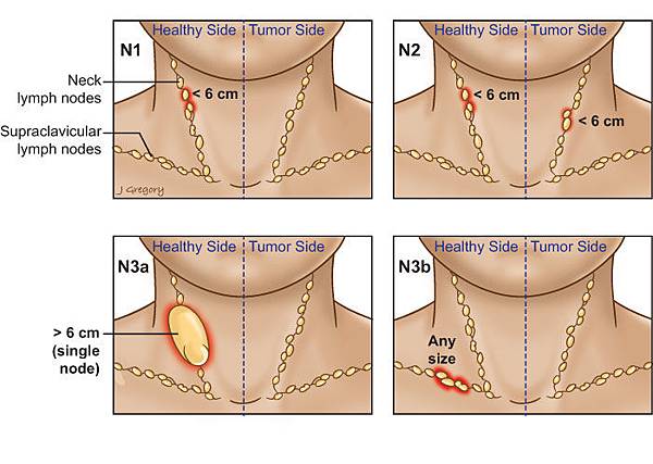 40_larynx_Nstages1.jpg