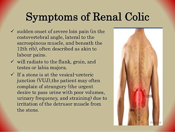 Flank Pain/Renal Colic