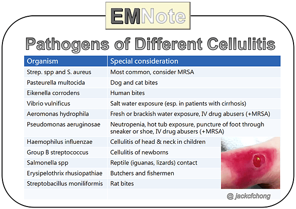 cellulitis_orig.png