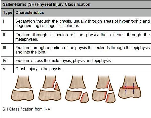 Salter-Harris-Physeal-Injury-Classification.jpg