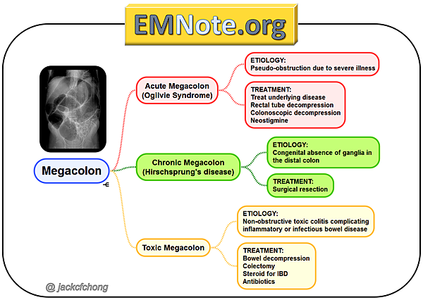 megacolon01_orig.png