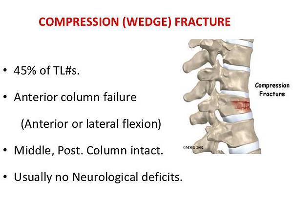 thoracolumbar-fracture-for-mbbs-17-638.jpg