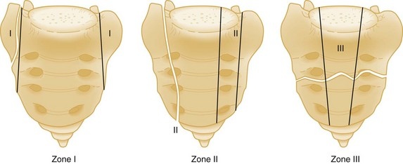 B9781455706051000555_f055-010-9781455706051.jpg