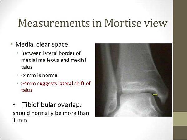 ankle-joint-radiography-20-638.jpg