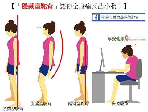 隱藏型駝背 讓你全身痛又凸小腹 新達文西物理治療所 自費醫療徒手治療運動治療 痞客邦