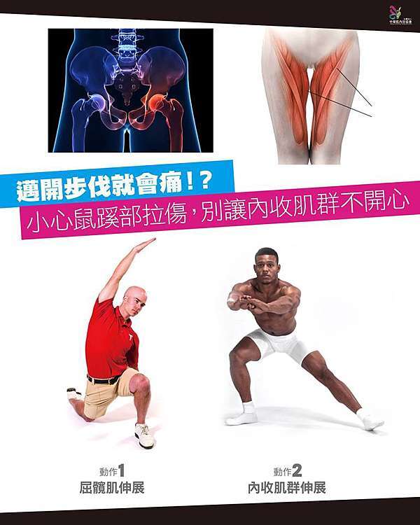 邁開步伐就會痛 小心鼠蹊部拉傷 別讓內收肌群不開心 新達文西物理治療所 自費醫療徒手治療運動治療 痞客邦 邁開步伐就會痛 小心鼠蹊部拉傷 別讓內收肌群不開心 新達文西物理治療所 自費醫療徒手治療運動治療 痞客邦