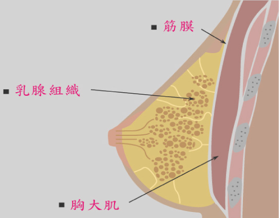 台中隆乳｜台中隆乳手術11