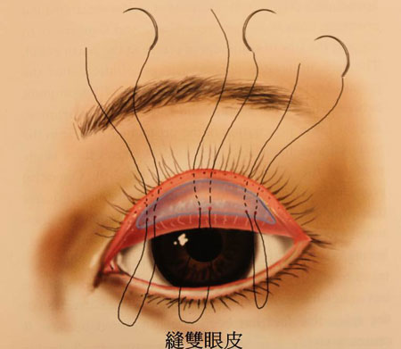 eye-17.jpg