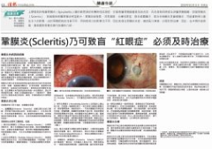 鞏膜炎（Scleritis）乃可致盲必须及時治療.PNG