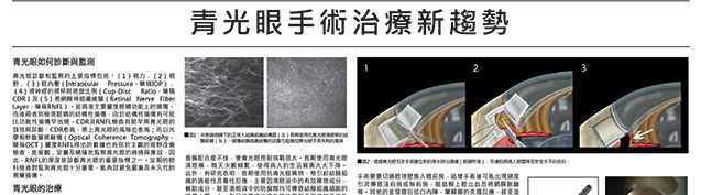 青光眼手術治療新趨勢療效.jpg