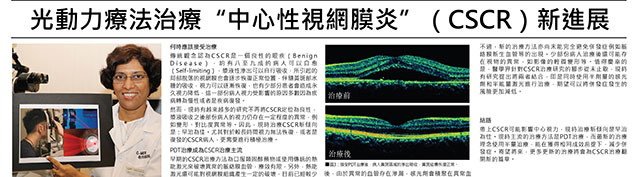 光動力療法治療“中心性視網膜炎”效果好.jpg