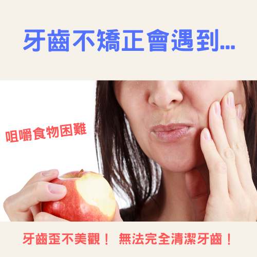 舌側矯正.png