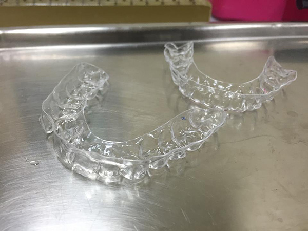 牙齒凌亂不敢笑開懷?量身訂做隱形牙套,搖身成為整齊潔牙自拍達人! 牙齒凌亂不敢笑開懷?量身訂做隱形牙套,搖身成為整齊潔牙自拍達人!
