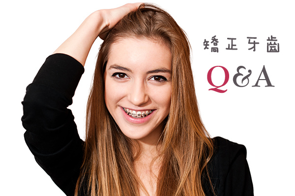 矯正牙齒Q&A|矯正牙齒迷思-正確矯正牙齒觀念