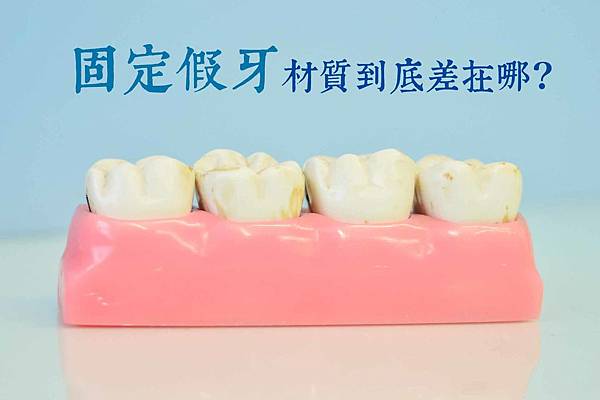 macromodelo-of-teeth-1437437_1920.jpg