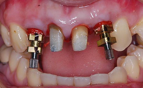 5 final impression (1).JPG