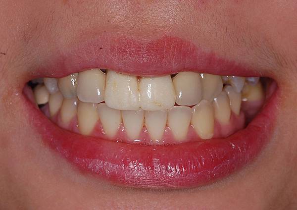 2. interim phase.jpg