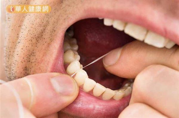 口腔清潔大不易,工具、步驟、方式缺一不可2 口腔清潔大不易,工具、步驟、方式缺一不可2