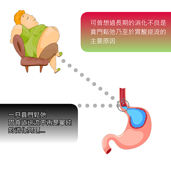 可曾想過長期的消化不良是賁門鬆弛乃至於胃酸逆流的主要原因之一.png