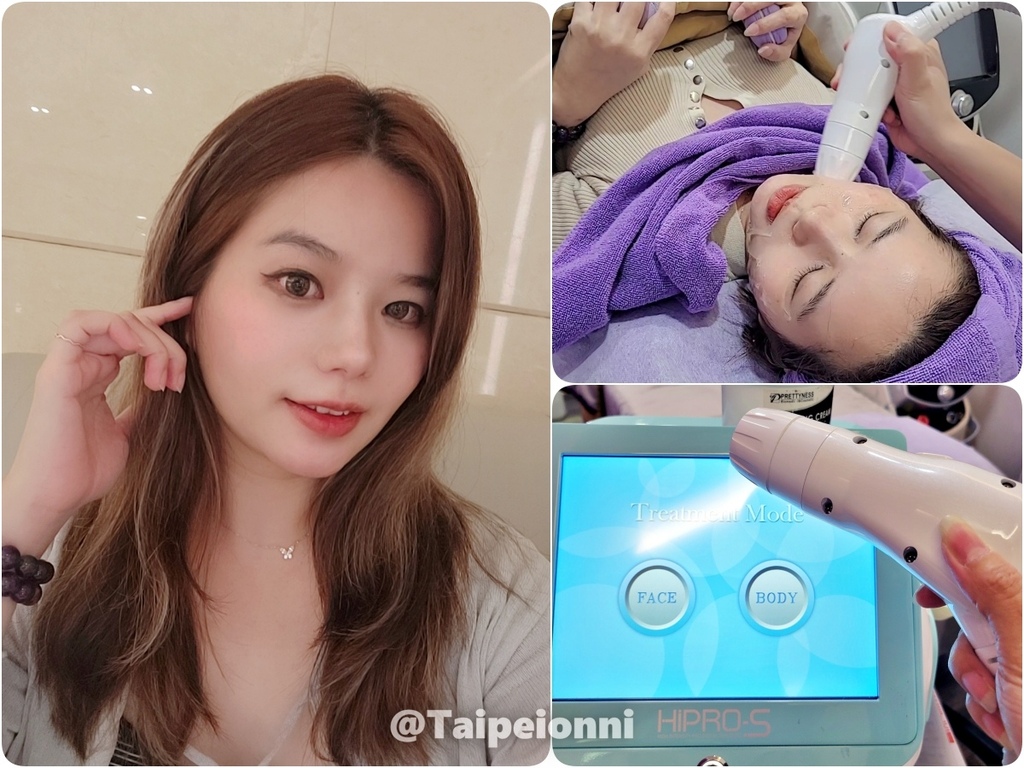 韓妞妞的美麗蛻變日記｜告別臉部肉肉困擾👋【愛爾麗診所】風靡韓