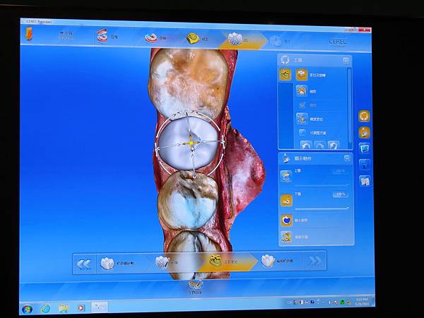 悅庭牙醫診所, DSD軟體 悅庭牙醫診所, DSD軟體