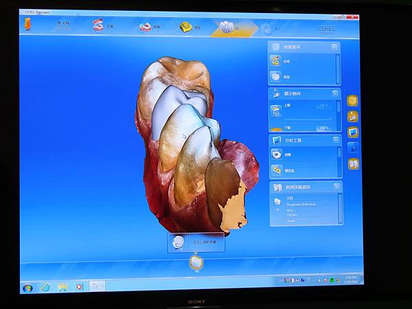 悅庭牙醫診所, DSD軟體 悅庭牙醫診所, DSD軟體