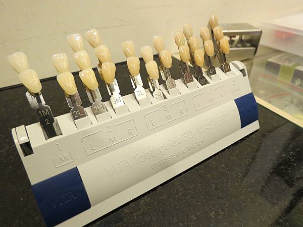 悅庭牙醫診所, 牙齒比色 悅庭牙醫診所, 牙齒比色