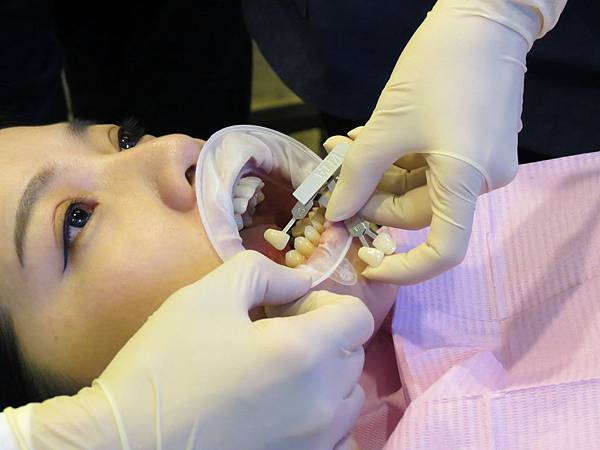 悅庭牙醫診所, 牙齒比色 悅庭牙醫診所, 牙齒比色