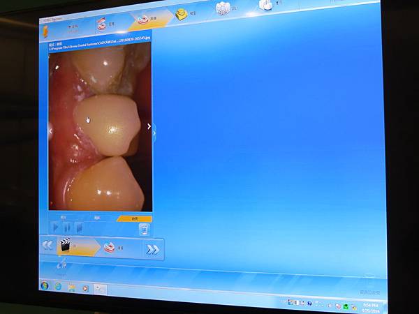 悅庭牙醫診所, 牙冠 悅庭牙醫診所, 牙冠