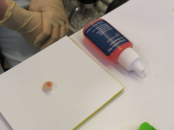 悅庭牙醫診所, 牙冠 悅庭牙醫診所, 牙冠