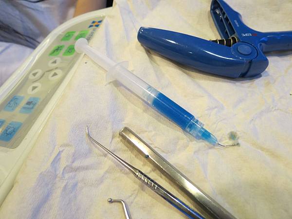 悅庭牙醫診所, 牙冠 悅庭牙醫診所, 牙冠