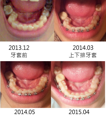 下排比較圖