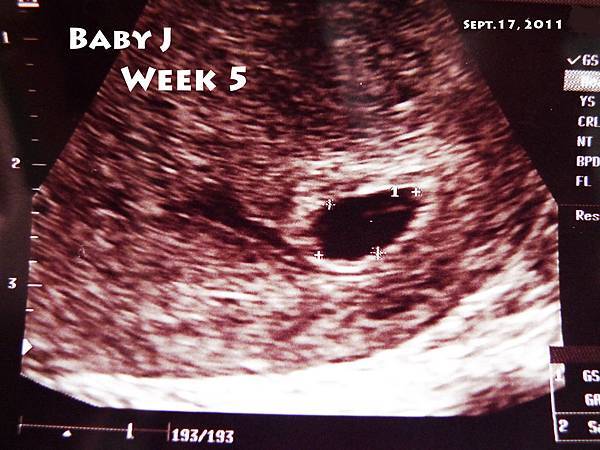 Baby J Week 5.jpg
