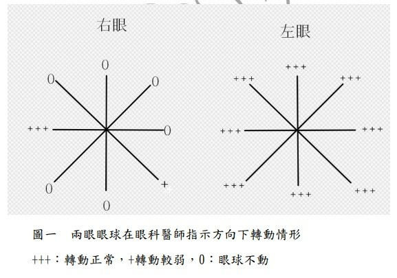 眼珠轉動情形(圖一).jpg