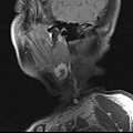 MRI 3.jpg