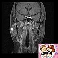 MRI 3 T1.jpg