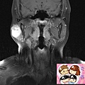 MRI CORONAL 2.jpg