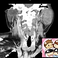 CT CORONAL 2.jpg