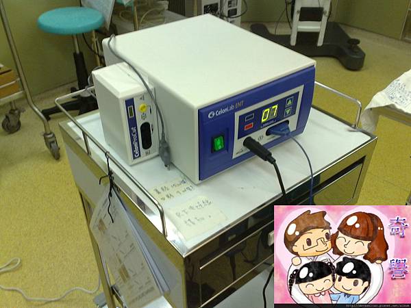 RF無線電波: 內視鏡微創治療打鼾與睡眠呼吸中止症