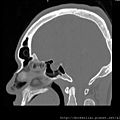 CT SAGITTAL2.jpg