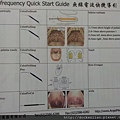 無線電波打鼾手術 Radiofrequency for Snoring & Sleep Apnea Syndrome