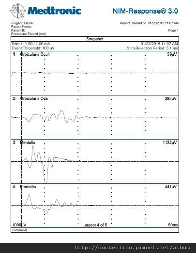 顏面神經探測器 IONM figure medtronic NIM 3