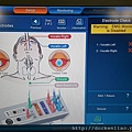 甲狀腺手術聲帶返喉神經監測電腦 IONM